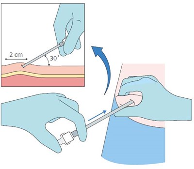 Step 4 (Step 4)